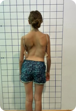 Antes